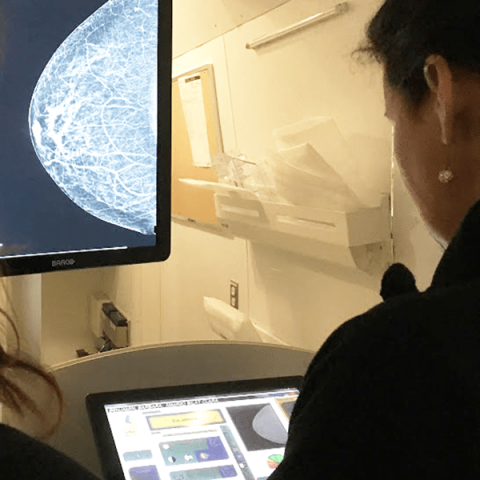 Woman looks at mammogram scan
